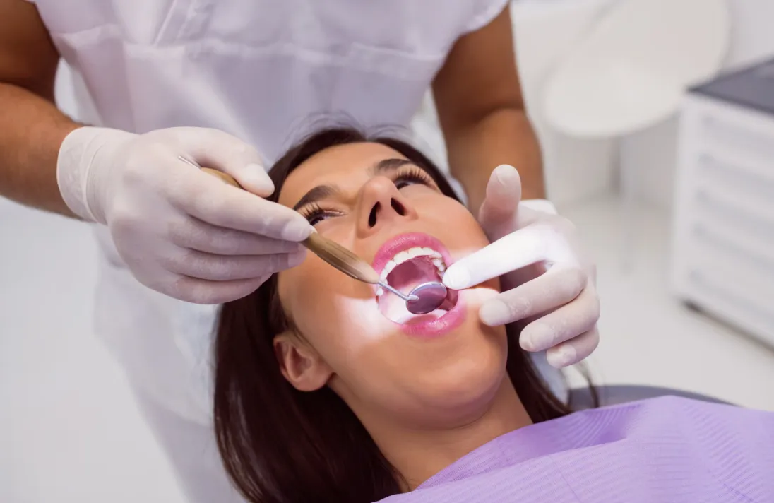 Teeth Cleaning, Scaling & Polishing